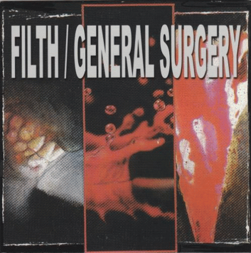 Filth (AUS) : Filth - General Surgery